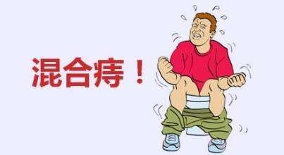 广州东大肛肠医院——混合痔.jpg