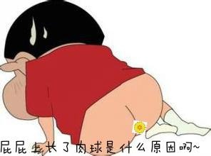 广州东大肛肠医院——刚门肉球.jpg