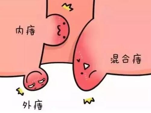 广州东大肛肠医院
