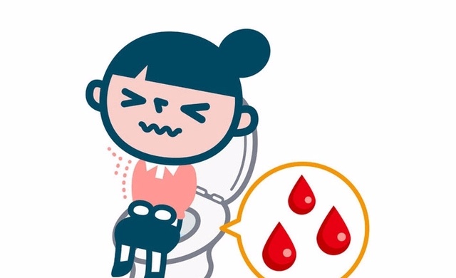 广州东大肛肠医院——大便出血.jpg